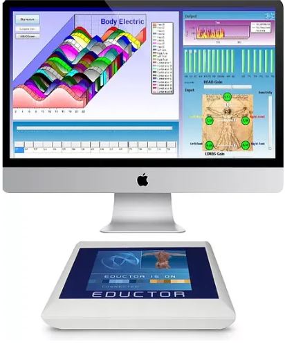 Quantum Biofeedback Scan Device Biofeedback scan device and screen